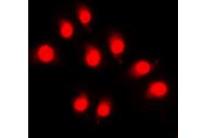 Immunofluorescent analysis of Rpb1 CTD (pSer5) staining in HeLa cells. (Rpb1 CTD anticorps  (C-Term, pSer5))