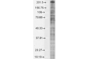 Nav1 8 Cos1 8 transient Western Blotting. (Nav1.8 anticorps  (AA 1724-1956))