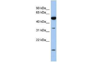 WB Suggested Anti-RDH12 Antibody Titration: 0.