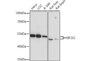 Western blot analysis of extracts of various cell lines, using EIF2S2 Rabbit pAb  at 1:3000 dilution.