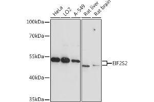Western blot analysis of extracts of various cell lines, using EIF2S2 Rabbit pAb  at 1:3000 dilution. (EIF2S2 anticorps  (AA 1-175))