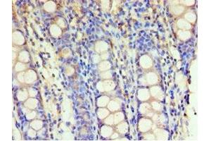 Immunohistochemistry of paraffin-embedded human colon tissue using ABIN7154112 at dilution of 1:100