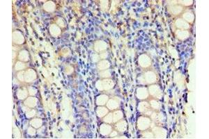 Immunohistochemistry of paraffin-embedded human colon tissue using ABIN7154112 at dilution of 1:100 (GSTM4 anticorps  (AA 1-218))