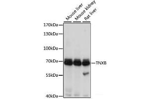 Western blot analysis of extracts of various cell lines using TNXB Polyclonal Antibody at dilution of 1:1000. (TNXB anticorps)