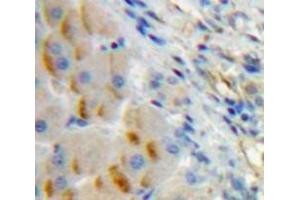 IHC-P analysis of Liver tissue, with DAB staining. (CD79a anticorps  (AA 30-193))