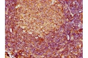 IHC image of ABIN7158533 diluted at 1:800 and staining in paraffin-embedded human lymph node tissue performed on a Leica BondTM system.