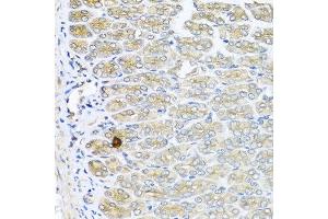 Immunohistochemistry of paraffin-embedded mouse stomach using IL6 antibody at dilution of 1:100 (40x lens). (IL-6 anticorps)