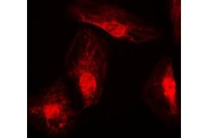 Immunofluorescent analysis of RANBP6 staining in K562 cells. (RANBP6 anticorps  (Center))