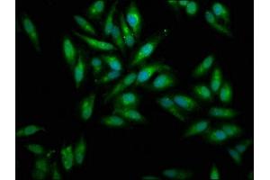 Immunofluorescence staining of Hela cells with ABIN7159428 at 1:100, counter-stained with DAPI. (Mesothelin anticorps  (AA 37-598))