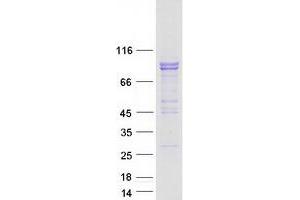 Validation with Western Blot