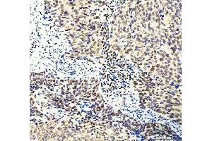 IHC analysis of DDX1 using anti-DDX1 antibody (ABIN7602050).