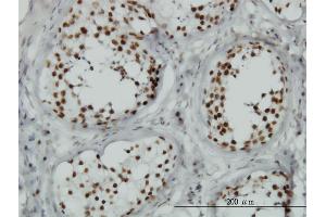Immunoperoxidase of monoclonal antibody to TLK1 on formalin-fixed paraffin-embedded human testis.