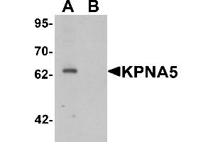 Western blot analysis of KPNA6 in EL4 cell lysate with KPNA5 antibody at 1 µg/mL in (A) the absence and (B) the presence of blocking peptide. (KPNA5 anticorps  (N-Term))