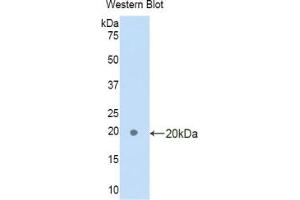 Western blot analysis of the recombinant protein. (FAM132A anticorps  (AA 92-241))