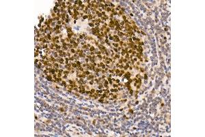 Immunohistochemistry of paraffin-embedded human tonsil using [KO Validated] DNMT1 Rabbit mAb (ABIN7266808) at dilution of 1:100 (40x lens).