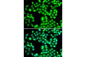 Immunofluorescence analysis of A-549 cells using YTHDC1 antibody.