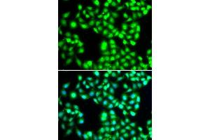 Immunofluorescence analysis of A-549 cells using YTHDC1 antibody. (YTHDC1 anticorps  (AA 260-500))