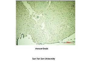 Immunohistochemistry (IHC) analysis:Please contact us for more details. (TH anticorps  (Tyr161))