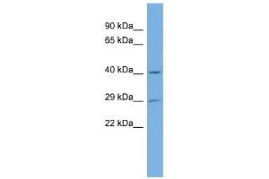 NAT15 antibody used at 1 ug/ml to detect target protein. (NAT15 anticorps)