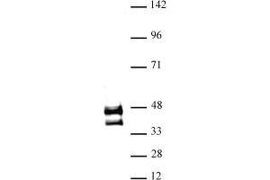 JunD antibody (pAb) tested by Western blot. (JunD anticorps  (N-Term))