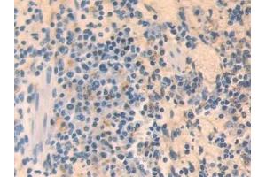 Detection of MX1 in Mouse Spleen Tissue using Polyclonal Antibody to Myxovirus Resistance 1 (MX1) (MX1 anticorps  (AA 43-308))