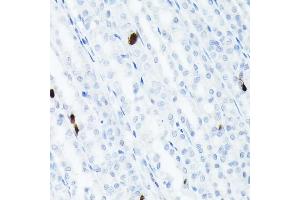 Immunohistochemistry of paraffin-embedded rat stomach using Somatostatin (SST) Rabbit mAb (ABIN7270492) at dilution of 1:1000 (40x lens).