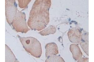 Detection of PTPRB in Rat Skeletal muscle Tissue using Polyclonal Antibody to Protein Tyrosine Phosphatase Receptor Type B (PTPRB)