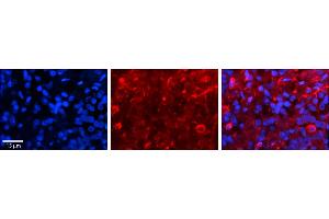 Rabbit Anti-SLC27A6 Antibody     Formalin Fixed Paraffin Embedded Tissue: Human Pineal Tissue  Observed Staining: Membrane and cytoplasmic in cell bodies of pinealocytes and their processes  Primary Antibody Concentration: 1:100  Other Working Concentrations: 1/600  Secondary Antibody: Donkey anti-Rabbit-Cy3  Secondary Antibody Concentration: 1:200  Magnification: 20X  Exposure Time: 0.
