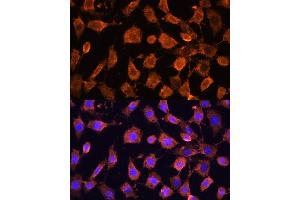 Immunofluorescence analysis of L929 cells using RPL11 antibody (ABIN6129101, ABIN6147106, ABIN6147108 and ABIN6222040) at dilution of 1:100.
