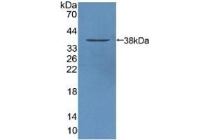 Detection of Recombinant STAM1, Mouse using Polyclonal Antibody to Signal Transducing Adaptor Molecule 1 (STAM1) (STAM anticorps  (AA 199-464))