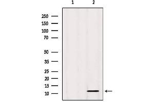 Western blot analysis of extracts from Mouse spleen, using CSTA Antibody. (CSTA anticorps  (C-Term))