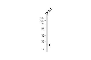 Western blot analysis of lysate from MCF-7 cell line, using NOS1 Antibody (Center) 10269c. (NOS1AP anticorps  (AA 437-466))
