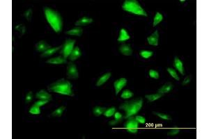 Immunofluorescence of monoclonal antibody to FTCD on HepG2 cell.