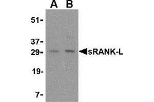 Western Blotting (WB) image for anti-Tumor Necrosis Factor (Ligand) Superfamily, Member 11 (TNFSF11) (Middle Region) antibody (ABIN1031107) (RANKL anticorps  (Middle Region))