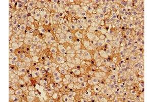 Immunohistochemistry of paraffin-embedded human adrenal gland tissue using ABIN7142312 at dilution of 1:100 (HSD17B7 anticorps  (AA 128-198))