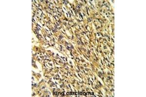 Immunohistochemistry (IHC) image for anti-Potassium Inwardly-Rectifying Channel, Subfamily J, Member 2 (KCNJ2) antibody (ABIN3002884)