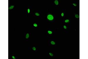 Immunofluorescence staining of U251 cells with ABIN7146450 at 1:133, counter-stained with DAPI. (CACYBP anticorps  (AA 2-228))