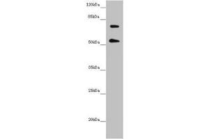 Western blot All lanes: ABCB8 antibody at 2. (ABCB8 anticorps  (AA 486-735))