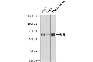 Western blot analysis of extracts of various cell lines using GLB1 Polyclonal Antibody at dilution of 1:1000.