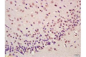 Formalin-fixed and paraffin embedded mouse brain labeled with Anti-ATF4/CREB-2 Polyclonal Antibody, Unconjugated (ABIN687862) at 1:200 followed by conjugation to the secondary antibody and DAB staining