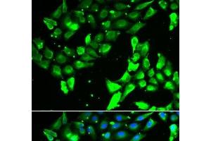Immunofluorescence analysis of A549 cells using KIF2B Polyclonal Antibody (KIF2B anticorps)