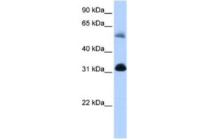 Western Blotting (WB) image for anti-3-Oxoacid CoA Transferase 1 (OXCT1) antibody (ABIN2463187) (OXCT1 anticorps)