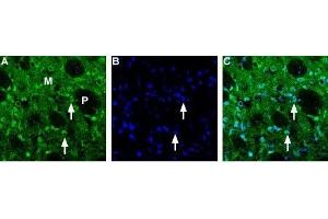 Expression of Choline transporter in rat striatum - Immunohistochemical staining of rat frozen brain sections using Anti-Choline Transporter (SLC5A7) (extracellular) Antibody (ABIN7043267 and ABIN7044218) (1:200).