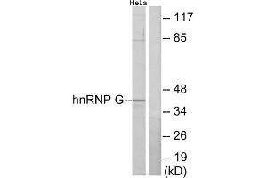 Western blot analysis of extracts from HeLa cells, using hnRNP G antibody. (RBMX anticorps  (N-Term))