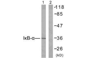 Western blot analysis of extracts from 293 cells untreated or treated with TNF-α (20ng/ml, 30min), using IκB-α (Ab-42) antibody (E021176). (NFKBIA anticorps)