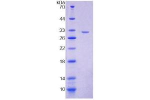 SDS-PAGE analysis of Mouse VARS Protein. (VARS Protéine)