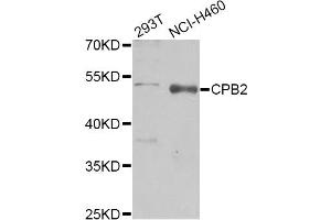 Western blot analysis of extracts of various cell lines, using CPB2 Antibody (ABIN1876835) at 1:1000 dilution. (CPB2 anticorps)