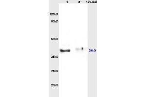 Lane 1: rat brain lysates Lane 2: rat kidney lysates probed with Anti Inhibin Alpha Polyclonal Antibody, Unconjugated (ABIN736656) at 1:200 in 4 °C.