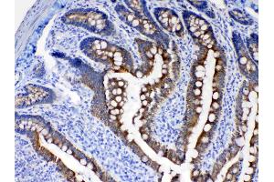 IHC analysis of Cytokeratin 8 using anti- Cytokeratin 8 antibody .