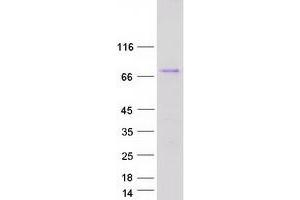 Validation with Western Blot